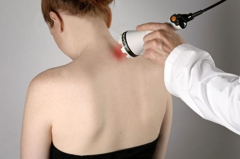 Laserová liečba cervikálnej osteochondrózy u žien